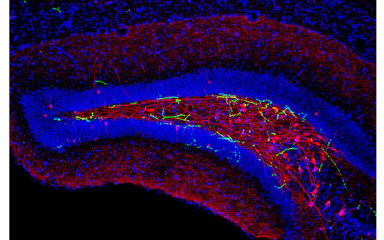 The brain stem also helps you remember