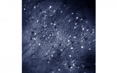 In vivo two-photon imaging