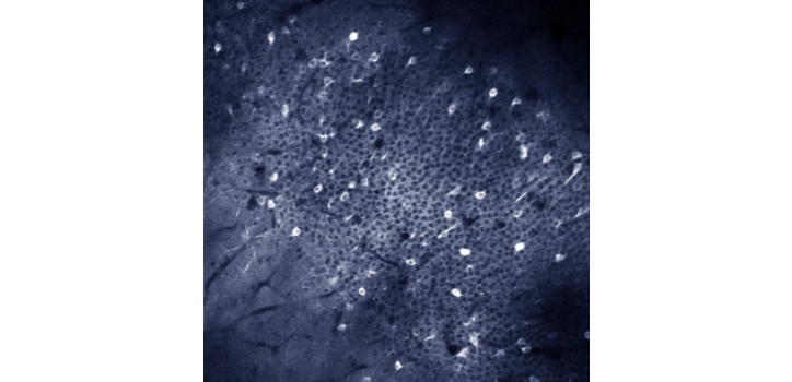 In vivo two-photon imaging diakép