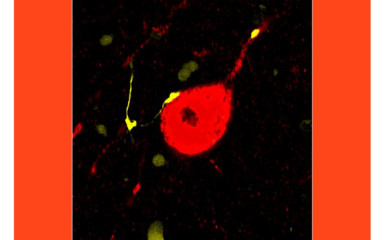 How does the brain learn from negative experiences?