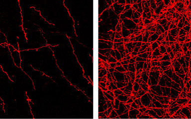 Why is it important to understand the brain's reward system?
