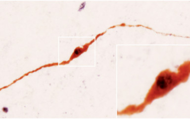 Immunohistochemistry