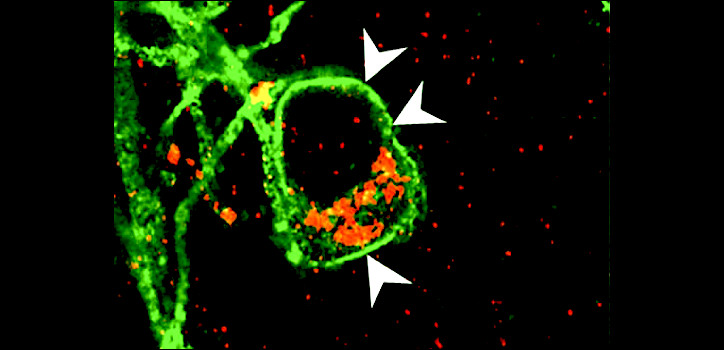 Channel rhodopsin 2-expressing neuron diakép