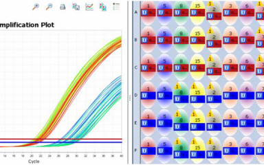 RT-qPCR studies of microdissected hypothalamic nuclei