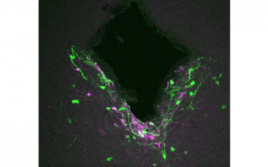 Viral tracing