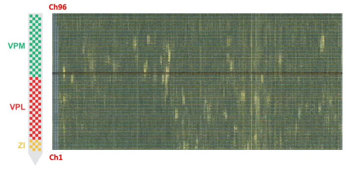 The new NeuroPixels experiments were just began diakép